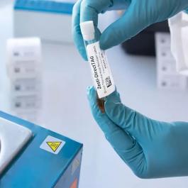 试管标签-试剂瓶贴标签定制